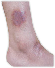 leg skin doctor in Mumbai