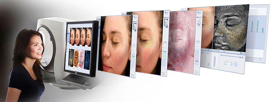 3D Imaging Skin Analysis