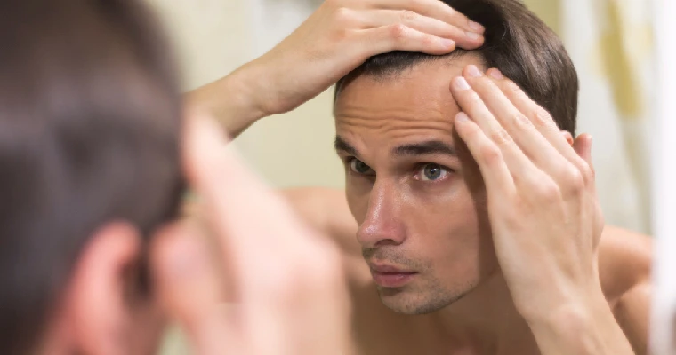 Restore Your Hair with Alopecia Areata Treatment