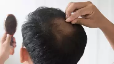 Genetic Factors Hair Loss and Their Effective Treatments in Mumbai