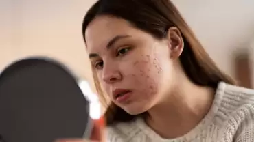 Psoriasis Treatment Options Available in Mumbai: Which One Is Right for You?