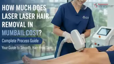 How Much Does Laser Hair Removal in Mumbai Cost? Complete Process Guide