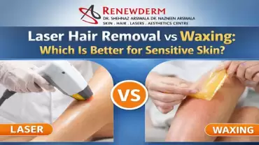 Laser Hair Removal vs Waxing: Which Is Better for Sensitive Skin?