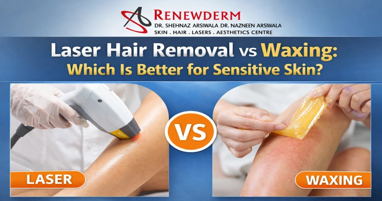 Laser Hair Removal vs Waxing: Which Is Better for Sensitive Skin?