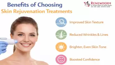 5 Benefits of Choosing Skin Rejuvenation Treatments for Healthy Skin