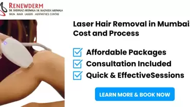Laser Hair Removal in Mumbai: Cost and Process