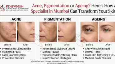 Acne, Pigmentation or Ageing? Here’s How a Skin Specialist in Mumbai Can Transform Your Skin