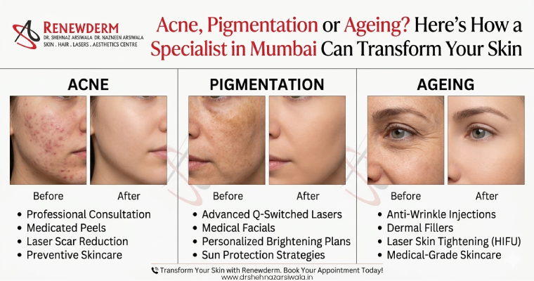 Acne, Pigmentation or Ageing? Here’s How a Skin Specialist in Mumbai Can Transform Your Skin