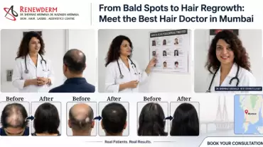 From Bald Spots to Hair Regrowth: Meet the Best Hair Doctor in Mumbai