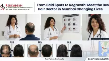 From Bald Spots to Regrowth: Meet the Best Hair Doctor in Mumbai Changing Lives