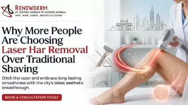 Why More People Are Choosing Laser Hair Removal Over Traditional Shaving