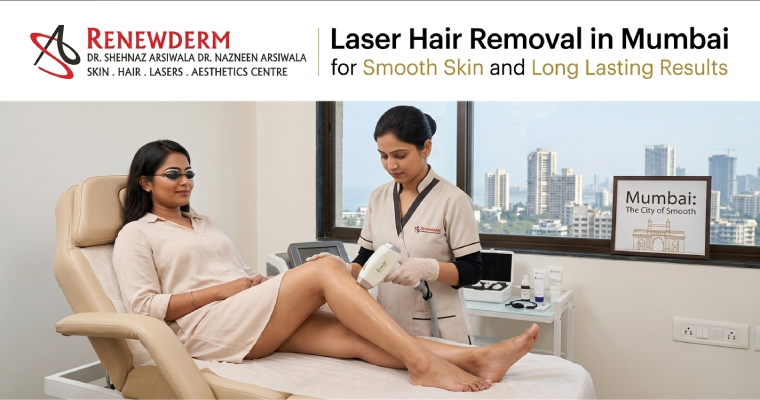 Laser Hair Removal in Mumbai for Smooth Skin and Long Lasting Results