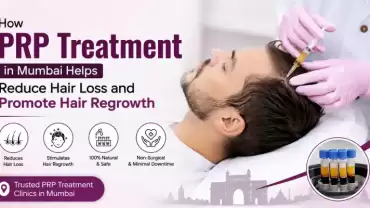 How PRP Treatment in Mumbai Helps Reduce Hair Loss and promote Hair Regrowth